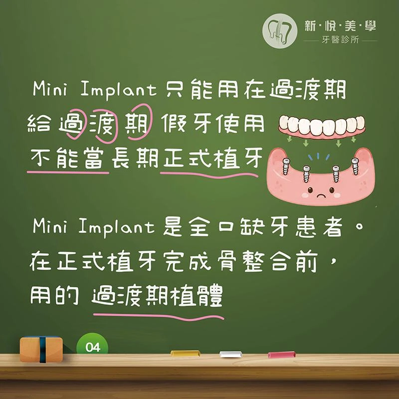 Mini Implant 為什麼會失敗？迷你植體適合長期植牙嗎？