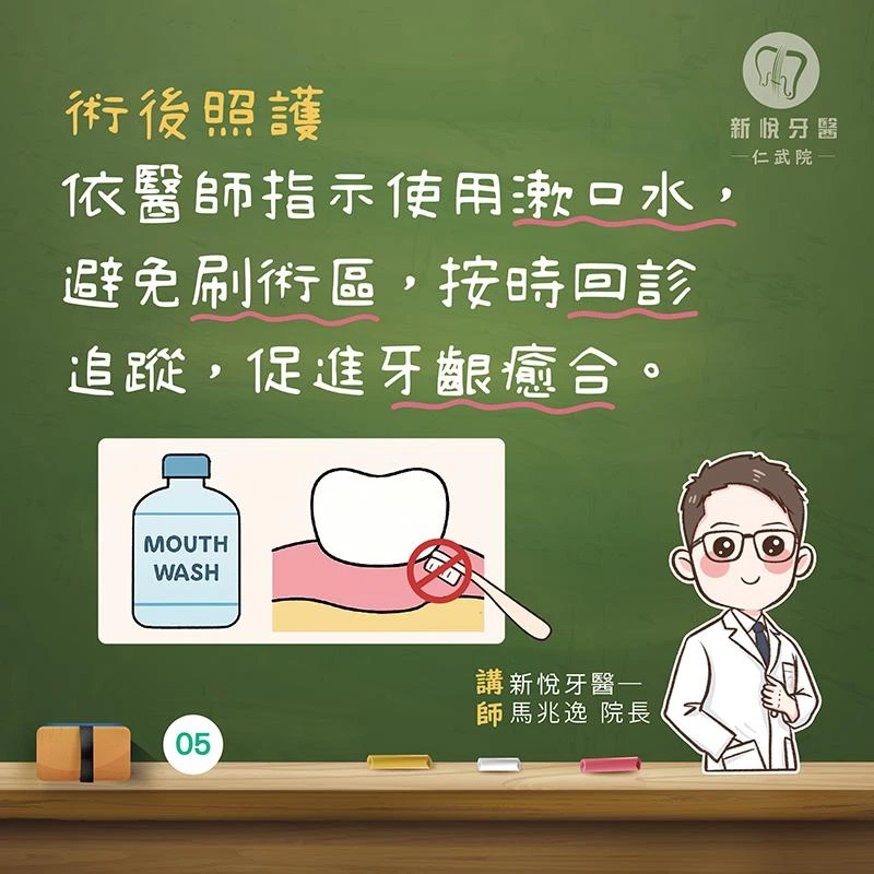 牙齦也能「補肉」?牙齦移植手術大解析! 牙齦也能「補肉」?牙齦移植手術大解析!