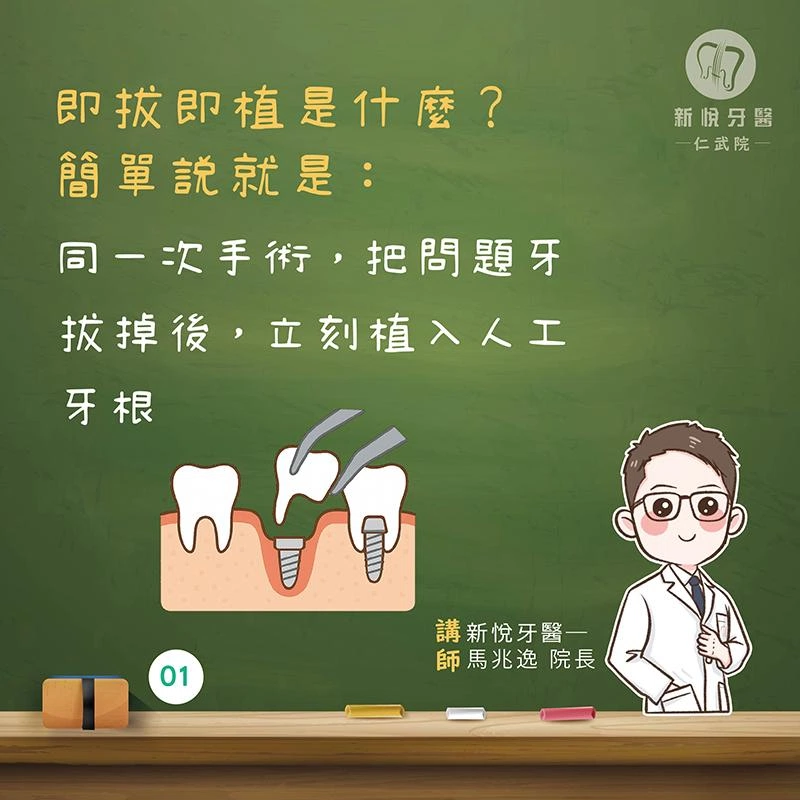 拔牙+植牙一次完成?即拔即植是什麼你知道嗎 拔牙+植牙一次完成?即拔即植是什麼你知道嗎