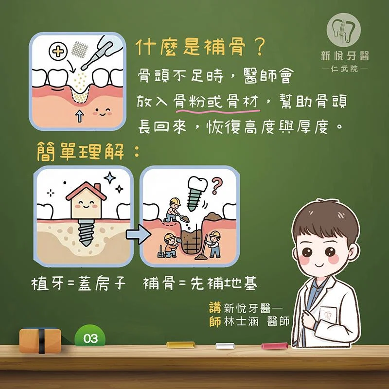 為什麼缺牙會導致骨頭流失？補骨與植牙關鍵一次看