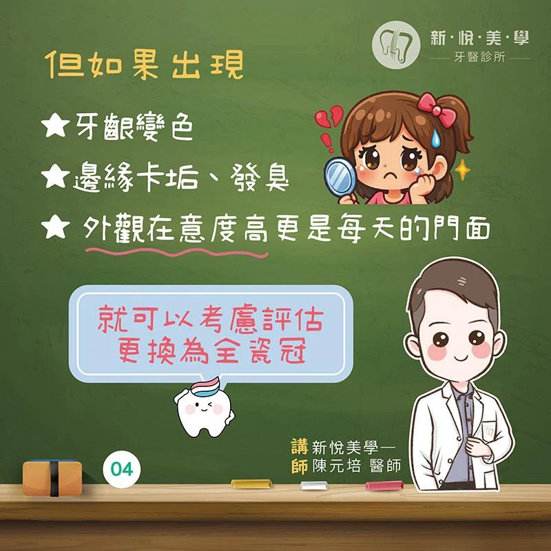 金屬牙套需要更換嗎？牙齦變黑、卡垢與全瓷冠一次看懂