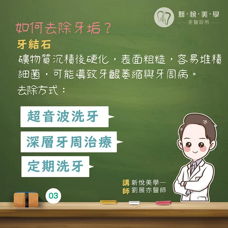 擺脫牙垢的束縛！讓你的牙齒『重見光明』