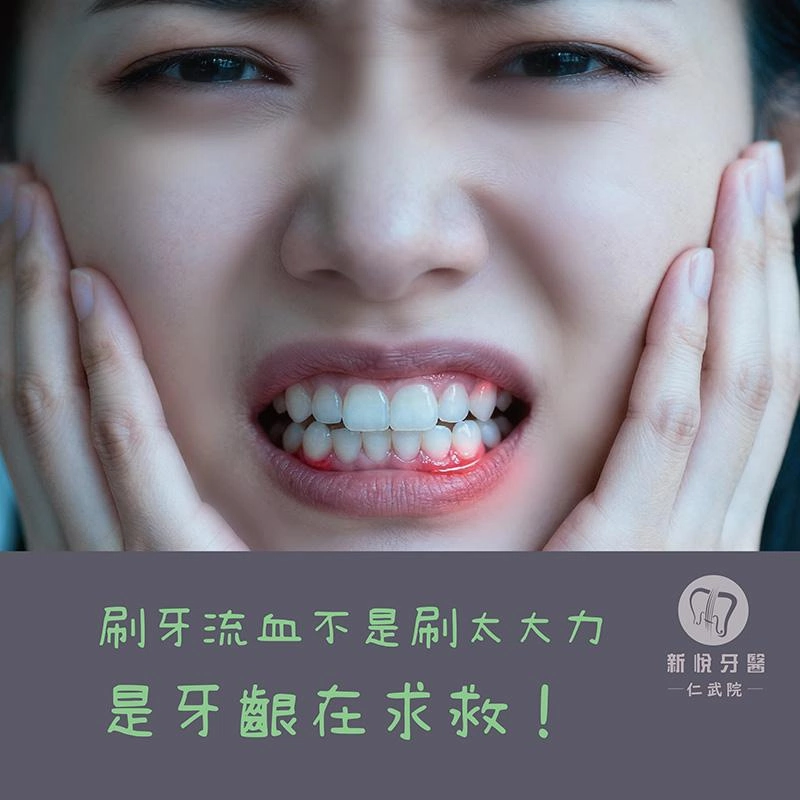 刷牙流血不是刷太大力,是牙齦在求救! 刷牙流血不是刷太大力,是牙齦在求救!