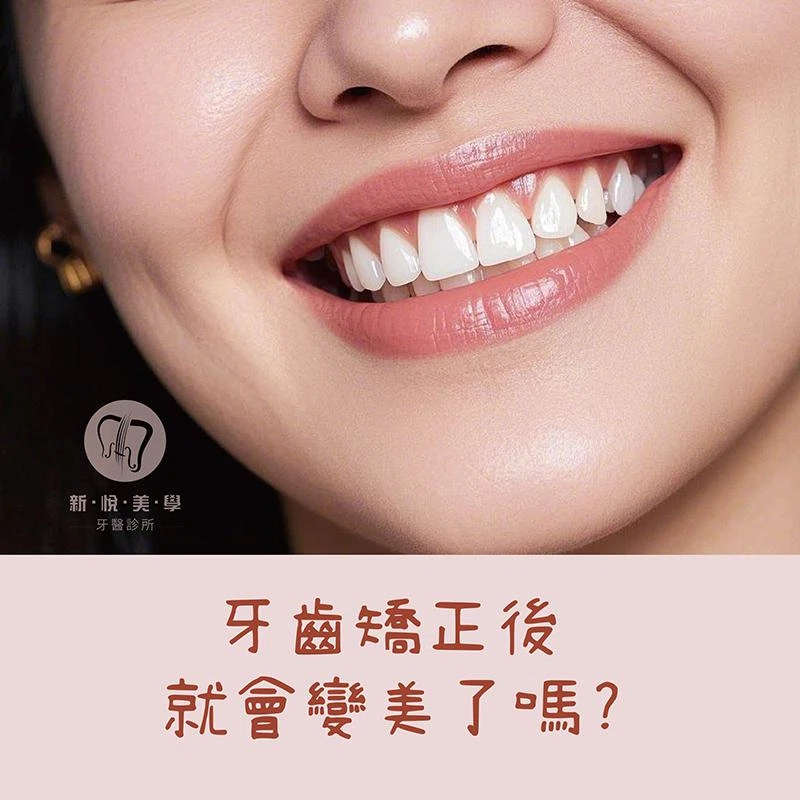 牙齒矯正後就會變美嗎？