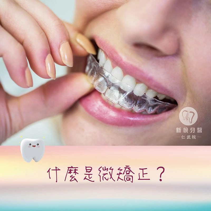 什麼是微矯正？