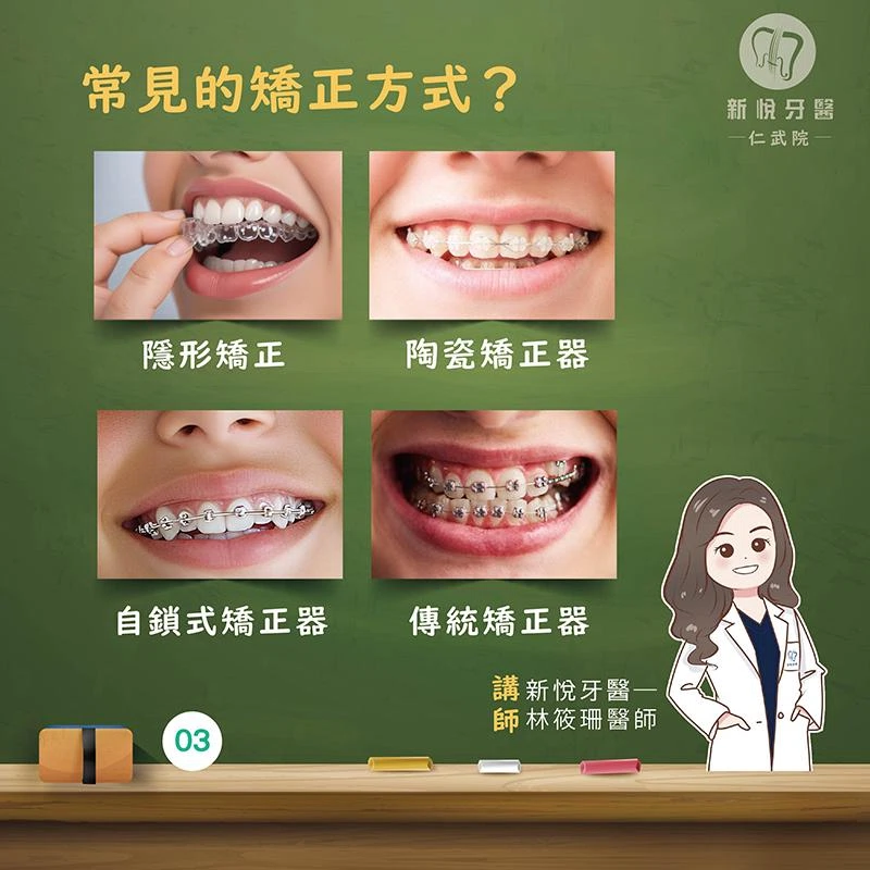 牙齒排列整齊,笑起來更迷人!口腔更健康! 牙齒排列整齊,笑起來更迷人!口腔更健康!