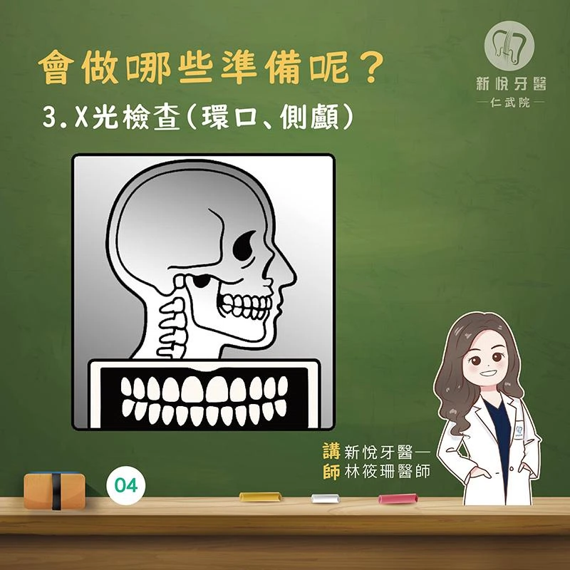 想開始牙齒矯正,第一步該做什麼? 想開始牙齒矯正,第一步該做什麼?