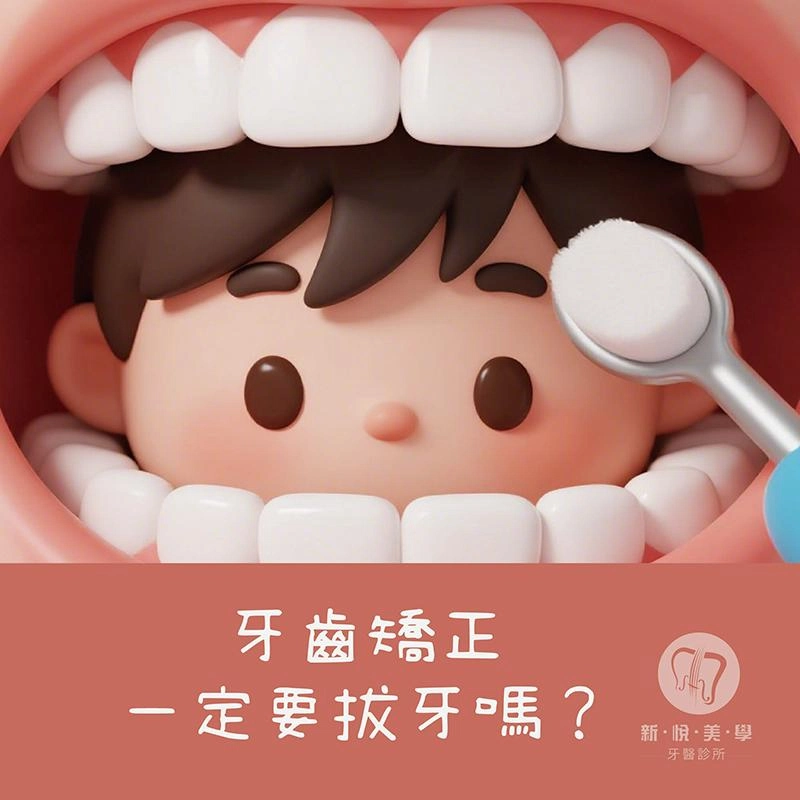 為什麼牙齒矯正有時需要拔牙？