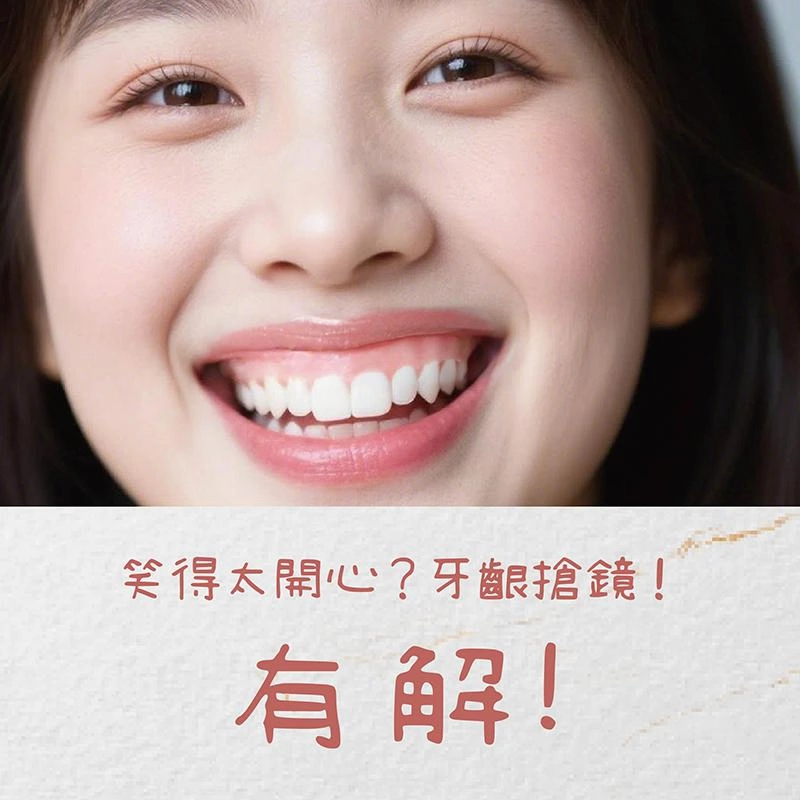 牙齦笑（Gummy Smile）原因是什麼？露牙齦原因與改善方式完整解析