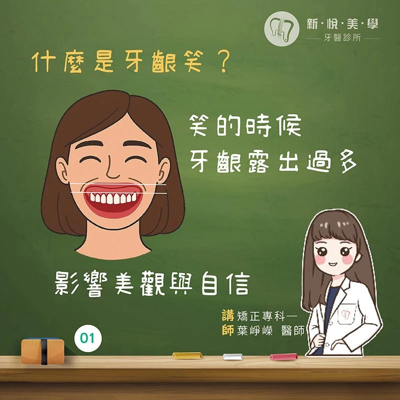 牙齦笑（Gummy Smile）原因是什麼？露牙齦原因與改善方式完整解析
