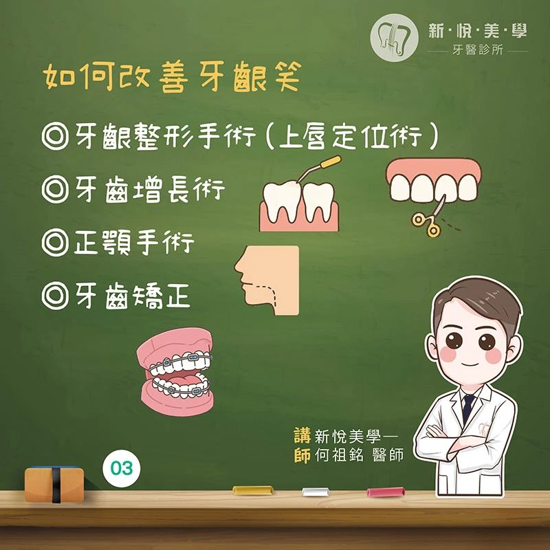 牙齦笑（Gummy Smile）原因是什麼？露牙齦原因與改善方式完整解析