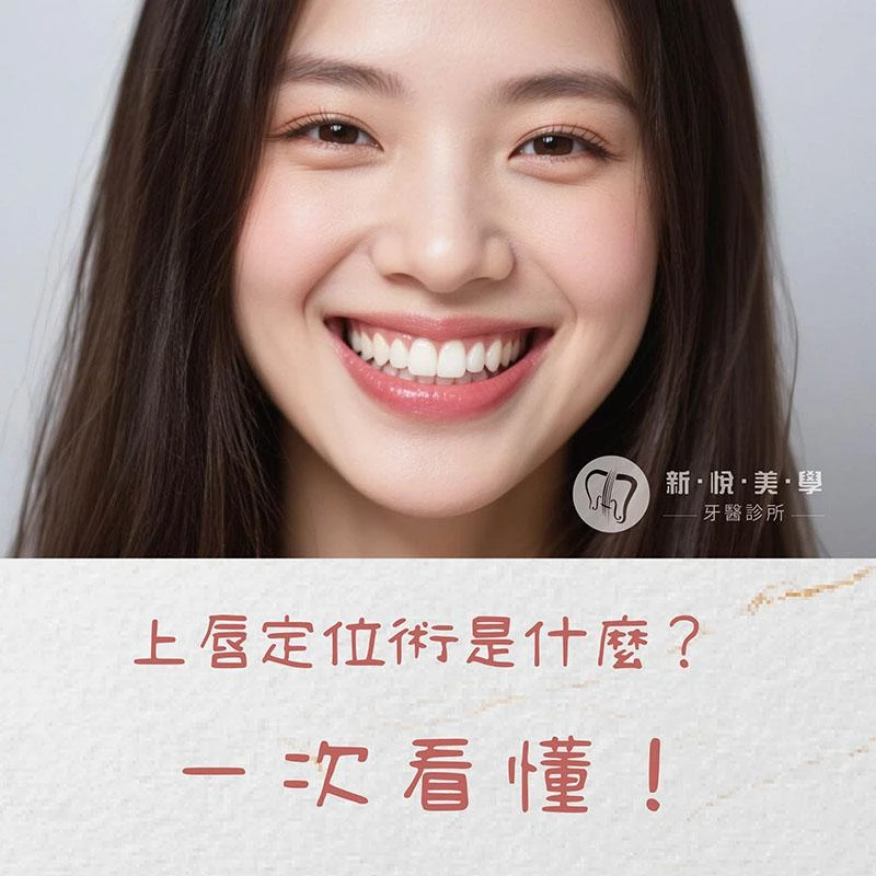 上唇定位術是什麼？一次看懂 Lip Lift、適合對象與術後恢復