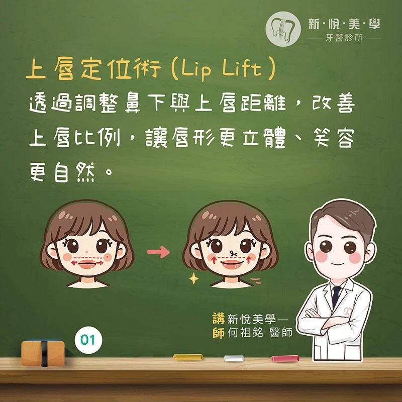 上唇定位術是什麼？一次看懂 Lip Lift、適合對象與術後恢復
