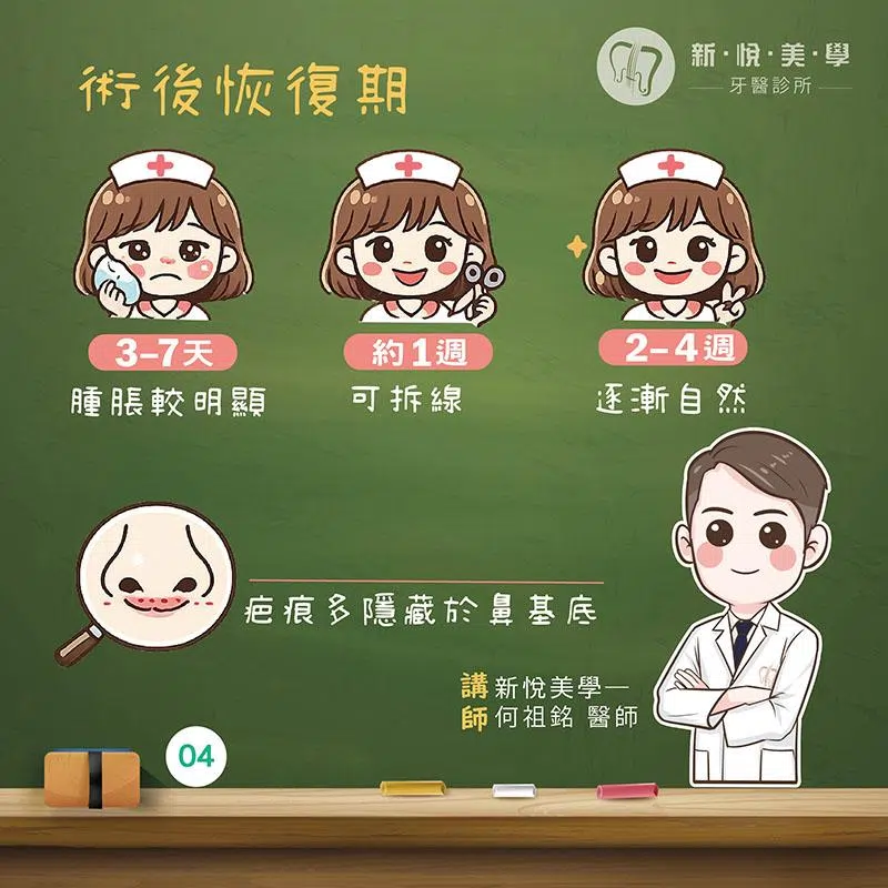 上唇定位術是什麼？一次看懂 Lip Lift、適合對象與術後恢復