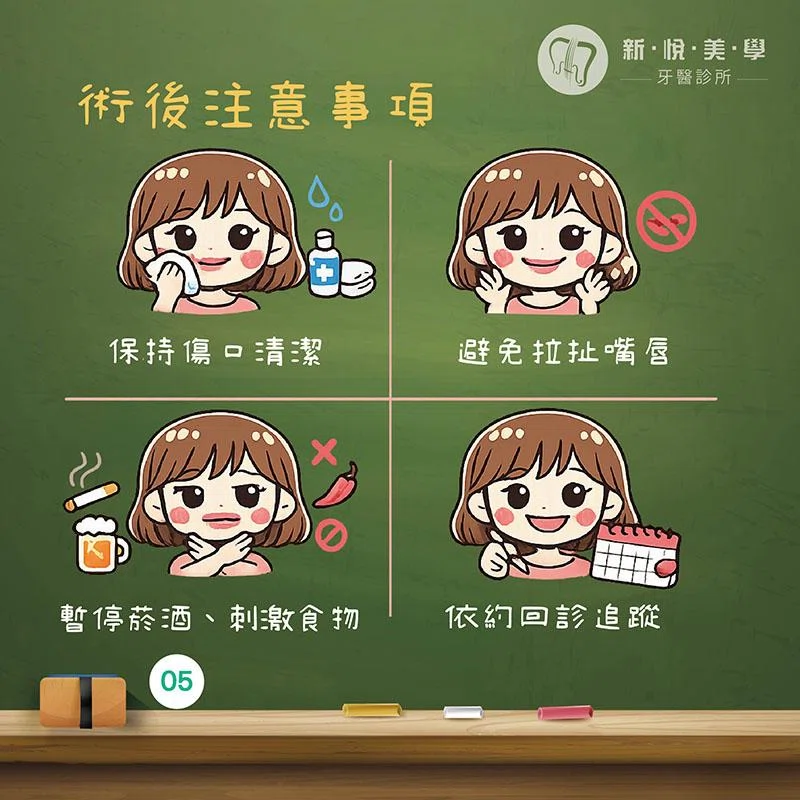 上唇定位術是什麼？一次看懂 Lip Lift、適合對象與術後恢復