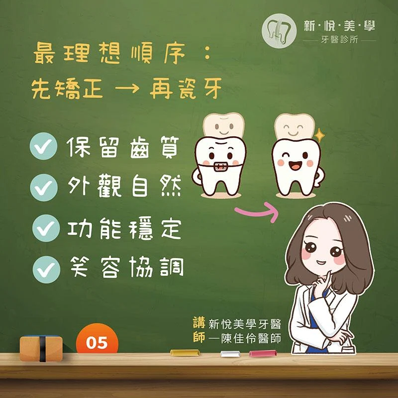 先排齊，再美化｜齒列矯正與瓷牙修復的治療順序怎麼選？