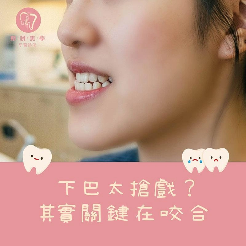 下巴太突出一定是骨頭問題嗎？從戽斗、前牙反咬認識咬合與臉型