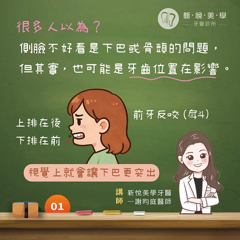 下巴太突出一定是骨頭問題嗎？從戽斗、前牙反咬認識咬合與臉型