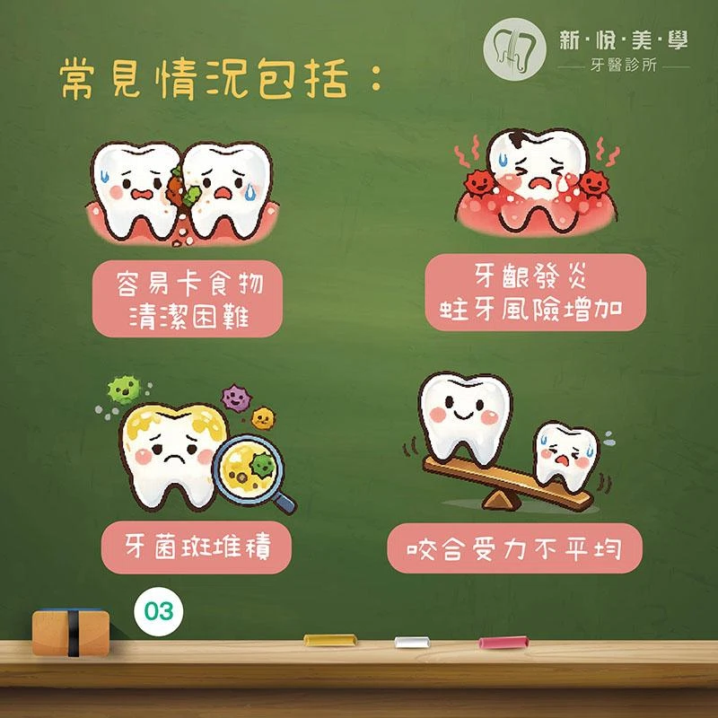 虎牙很可愛，要矯正嗎？認識虎牙、犬齒功能與矯正評估