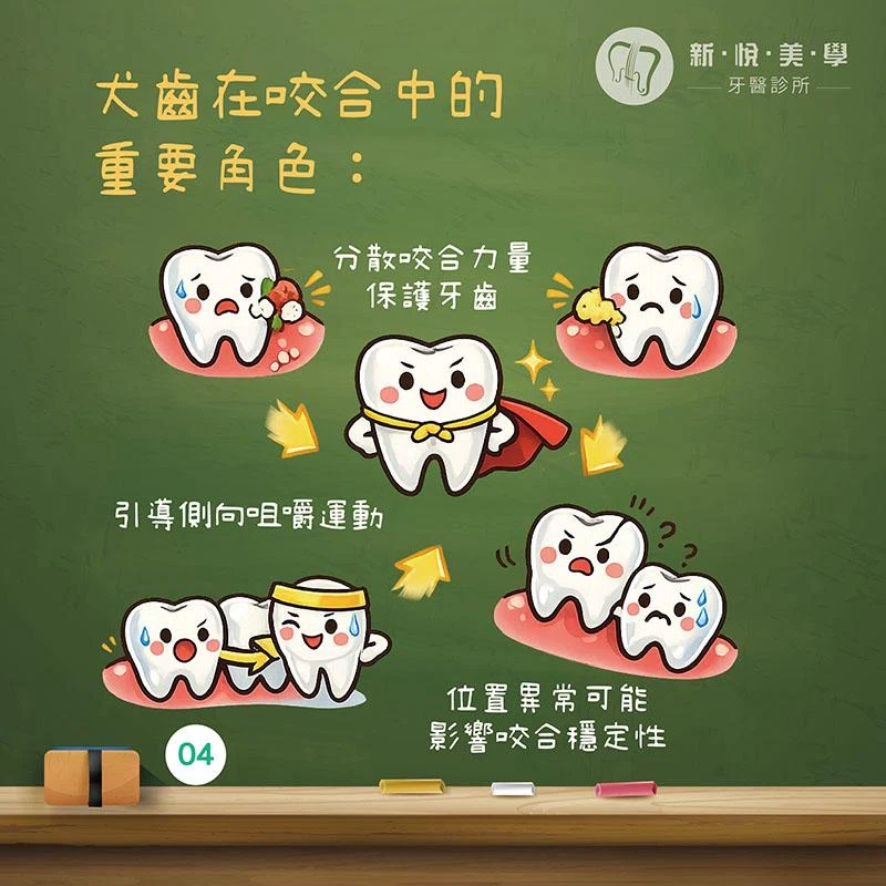 虎牙很可愛，要矯正嗎？認識虎牙、犬齒功能與矯正評估