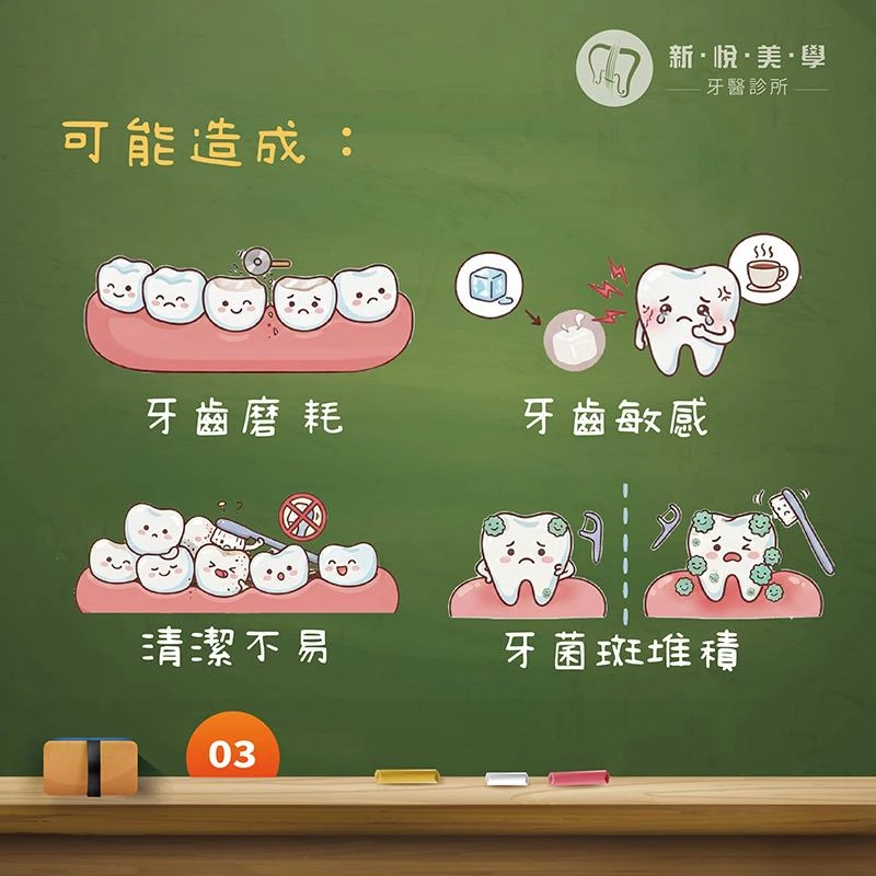 你的牙齒每天都在「打架」？認識咬合不正與牙齒磨耗