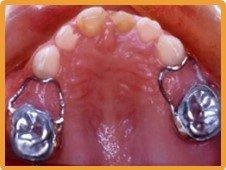 兒童牙科 兒童牙科