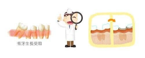 兒童牙科 兒童牙科