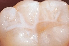 兒童牙科 兒童牙科