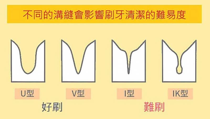 兒童牙科 兒童牙科