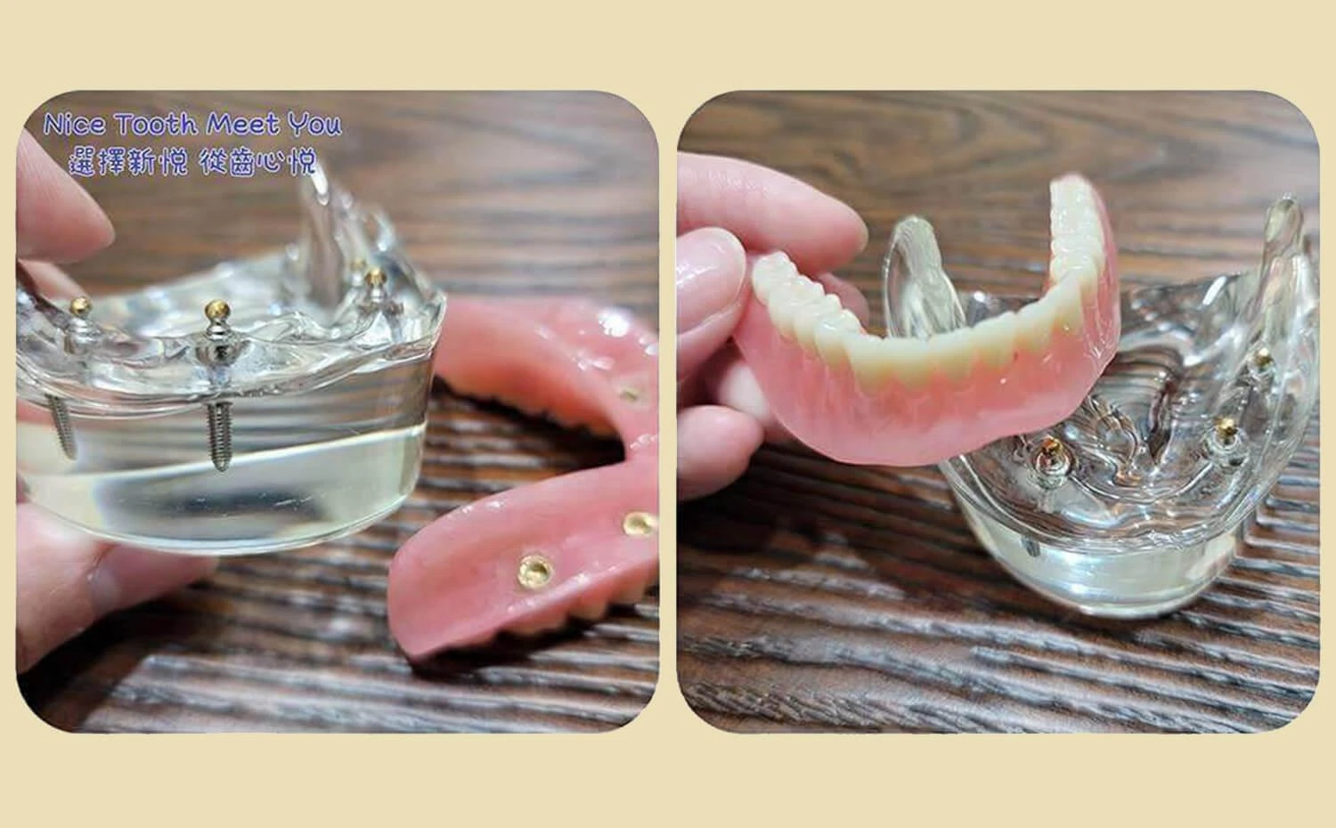活動式假牙